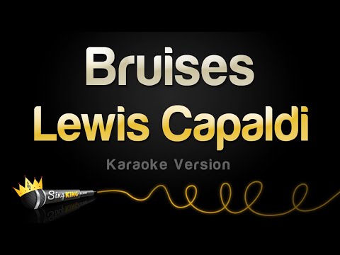 Lewis Capaldi - Bruises